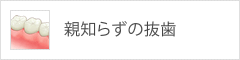 親知らずの抜歯